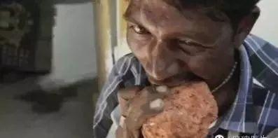 家长注意！9岁女孩老是呕吐还经常腹痛！竟是因为这个