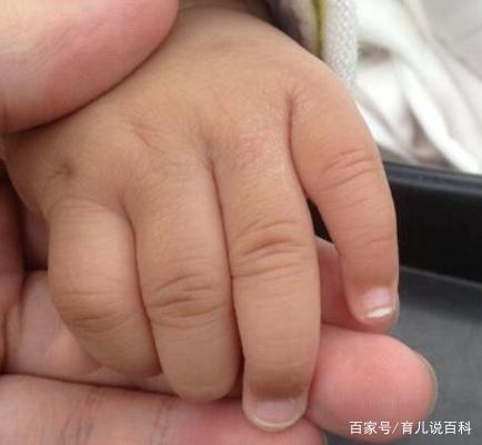 宝妈不要这样给宝宝剪指甲，他们皮肤细嫩，会剪伤到手指
