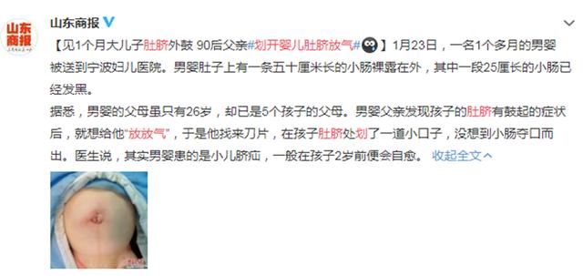 90后父亲划开一月大男婴肚脐放气，小儿脐疝的这些症状父母要重视