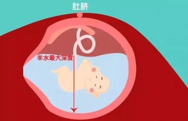 羊水少了怎么办呢？清风计划