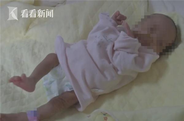 3斤多早产女婴吃不进奶 医生一查她食道竟是断的