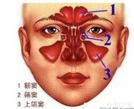 五岁的孩子为什么会犯鼻窦炎，该怎么缓解？