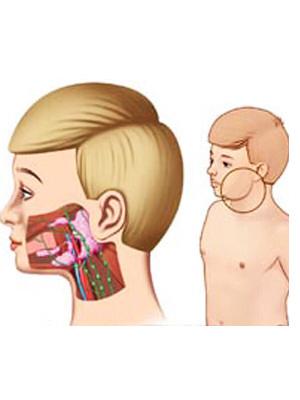 发现“痄腮”不在意，6岁男童左耳中度耳聋