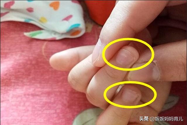孩子缺锌会影响发育，家长要重视，这些辅食1周吃2次补锌效果翻倍