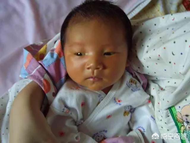 新生儿第七天，黄疸最高16.7，需要照蓝光吗？