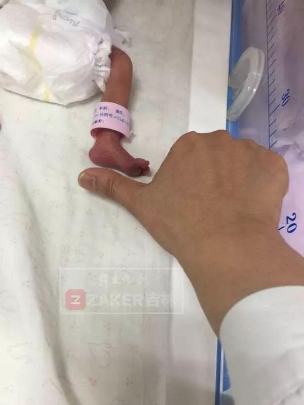 恭喜！体重950克的超低出生体重儿小豆丁，大年三十回家过年啦