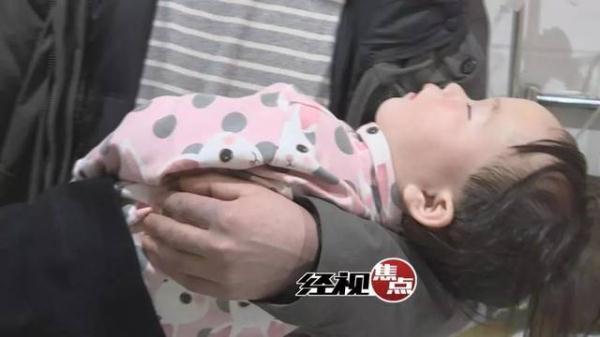 1岁女童吃饭时哭闹，辣椒呛入支气管