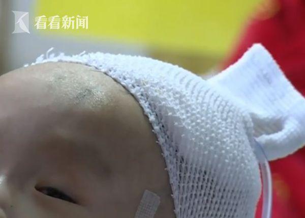男婴出生8.8斤1年后瘦成“骷髅人” 罪魁祸首太吓人