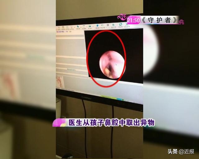 1岁多宝宝鼻腔里进了瓜子，家长一定注意不要让孩子碰这些东西！