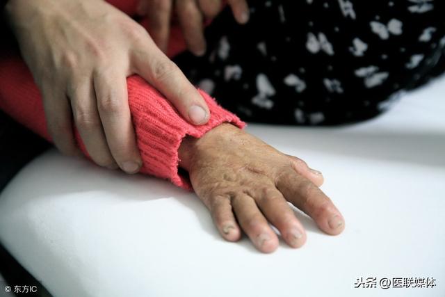 一不小心烫伤了怎么办？这3个步骤，快速止痛避免留疤