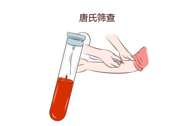 家长如何照顾唐宝宝，父母应该注意什么？