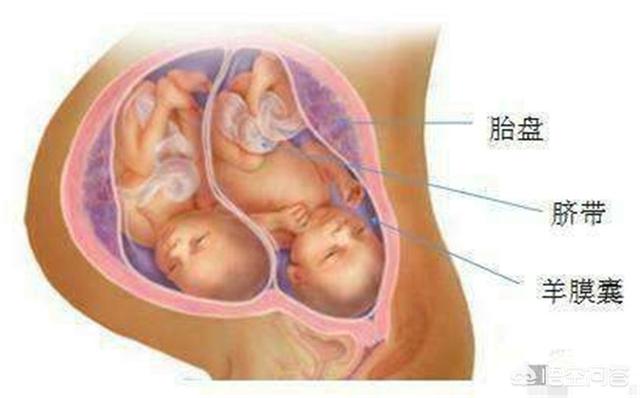 双胞胎一定会早产吗？