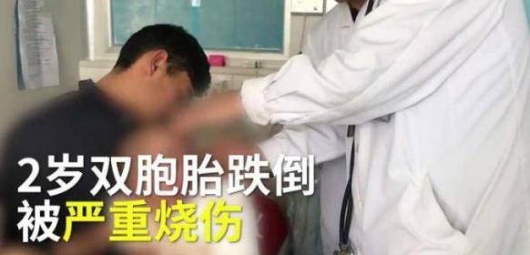 2岁双胞胎姐妹跌倒火炉旁，开水被打翻致姐妹俩严重烧伤
