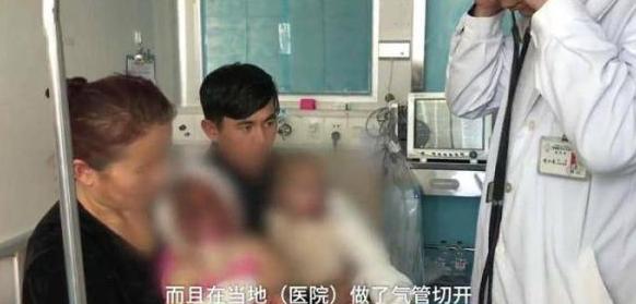 2岁双胞胎姐妹跌倒火炉旁，开水被打翻致姐妹俩严重烧伤