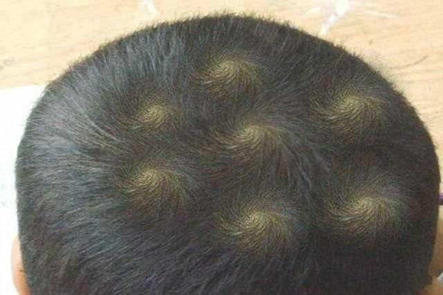 孩子头旋越多脾气越差？长哪个位置高智商？很多家长想错了