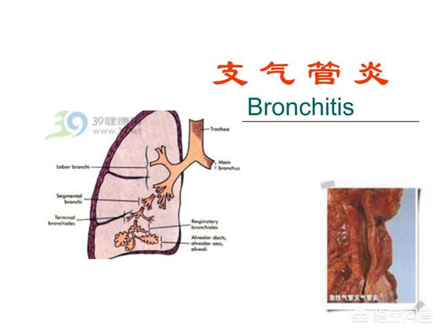 如何区分孩子患上的是支气管炎还是感冒？