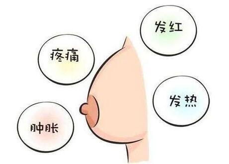 产后涨奶，苦不堪言！缓解有妙招get!