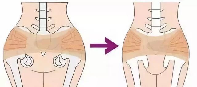 1s消除假胯宽!日本女性“骨盆整形”标配,帮你边睡变矫正!