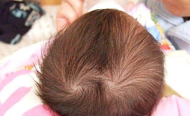 孩子头上的“头旋”个数代表什么？或许多数父母都不知道，别错过
