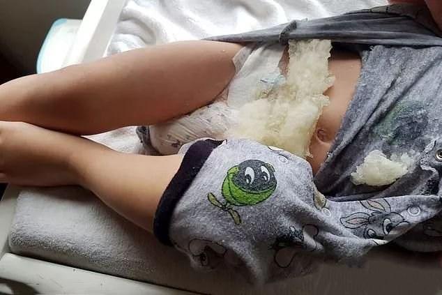 可怕！全球知名宝宝纸尿裤爆炸，妈妈要学会挑选适合宝宝的纸尿裤