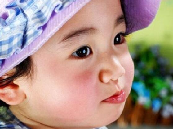 冬天孩子“苹果脸”是什么原因？冬天宝宝用什么面霜好？