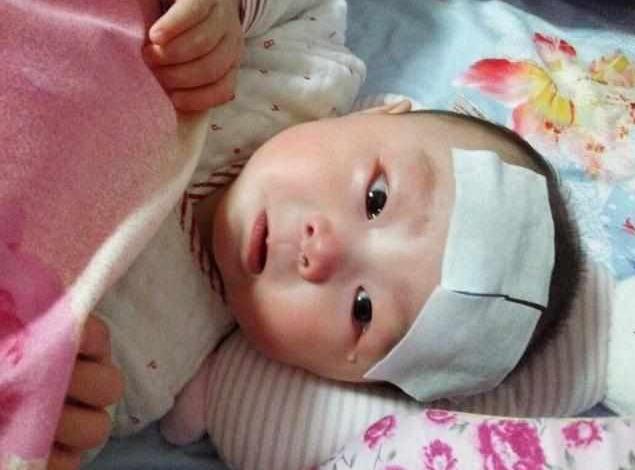 1岁宝宝总是无故流泪,医生检查后,竟从鼻腔掏出这东西