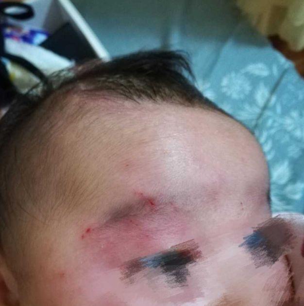 男婴过年期间惨遭4岁女童暴打！宝妈却只能忍气吞声：女童“后台”太硬了！
