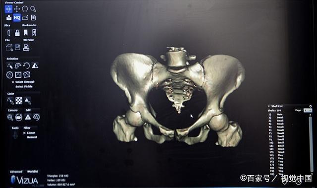 临近预产期,若孕妇有这3个情况出现,可能和顺产无缘了!