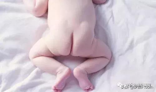  妈妈，我长了尿布疹，干坏事的“凶手”，可不止一个！