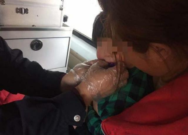 两岁女娃玩玩具，突然开始吞食，5厘米的玩具卡喉，咽不下出不来