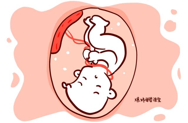 脐带绕颈的原因，其实就这三点，孕妈没必要过分紧张