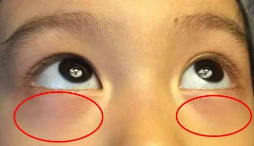 家长2个坏习惯，容易造成宝宝脾胃不和，很多家长不知道