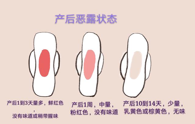产后恶露淋漓不尽，是因为忽视了这5点，产妇早注意恶露早排干净