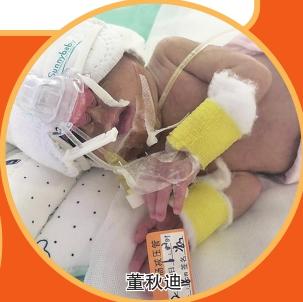 双胞胎器官发育不全 妈妈画幸运蛋祈福
