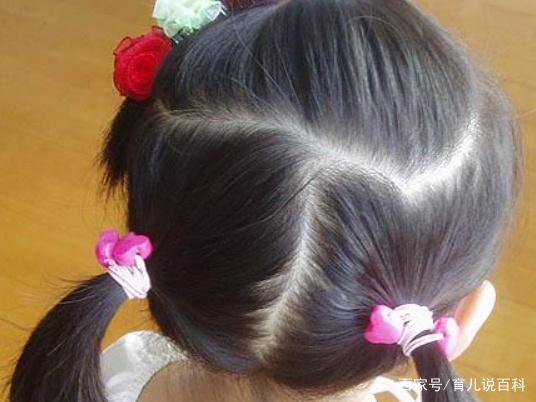 宝妈请注意：别再给女儿扎这种辫子，可能会让孩子长不出头发！