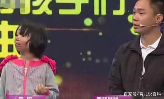 7岁女孩全身烧伤，多次进行整容手术，摘下面具后，看着让人心疼