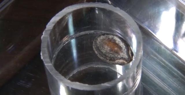 7岁男童咳了1年都没好，医生检查后，被他家长气坏了！