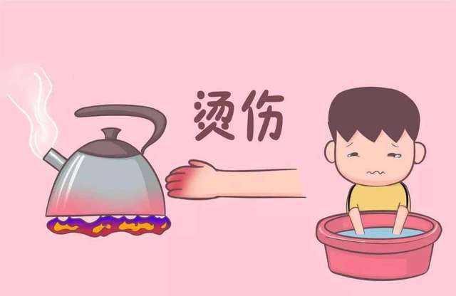 孩子烧烫伤涂牙膏？别坑娃，快来学习正确急救措施