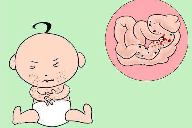 宝宝排便酸臭而且带泡沫，不妨自查一下，妈妈早知道才好