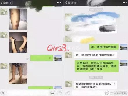 全身紫斑还发烧，母亲带着孩子“打飞的”从伦敦来杭州求医