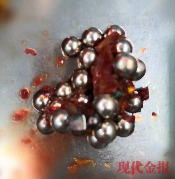 4岁男童吞下这种网红玩具20颗，致肠穿孔！这些东西快收好！
