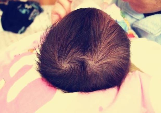 孩子有几个头旋,和性格有关系吗?看完后你就知道了!