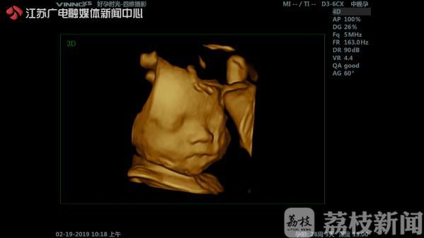 胎儿摄影藏“猫腻”，送小礼品暗示性别？