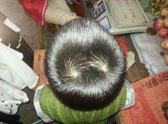 孩子有几个头旋,和性格有关系吗?看完后你就知道了!