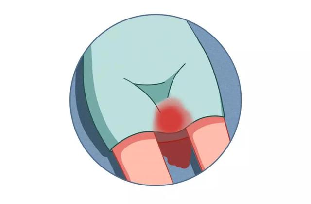 女朋友是流产体质，敢结婚吗？易流产的女性有一种和她的职业有关