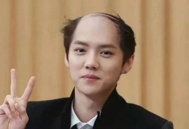 4种遗传病，可能传男不传女，若夫妻一方有，还是生女儿的好！