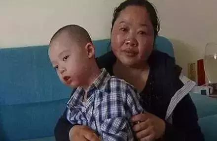 治湿疹的秘诀是抹润肤霜！