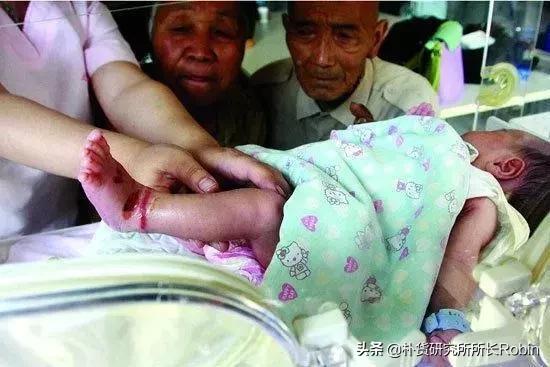 出生几天的宝宝面临截肢，这种袜子请别给宝宝穿，危害非常大！