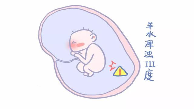 8个月孕妇突然羊水浑浊，胎儿出现缺氧,送医后,医生呵斥婆婆无知