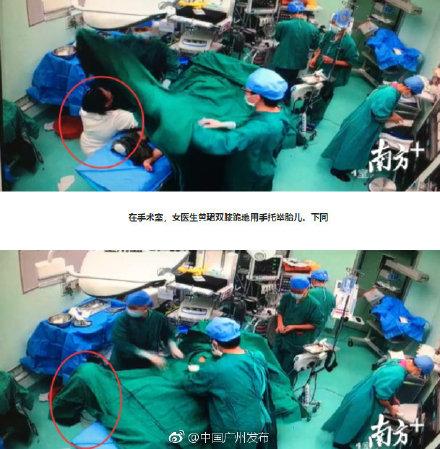 孕妇脐带脱垂，医生跪地托举，33秒“抢出”宝宝